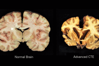 How to Watch NFL on Thanksgiving Online Without Cable