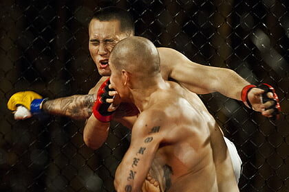 Aspinall diagnosed with rare eye condition