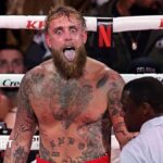 Paul goes to hospital with suspected broken jaw