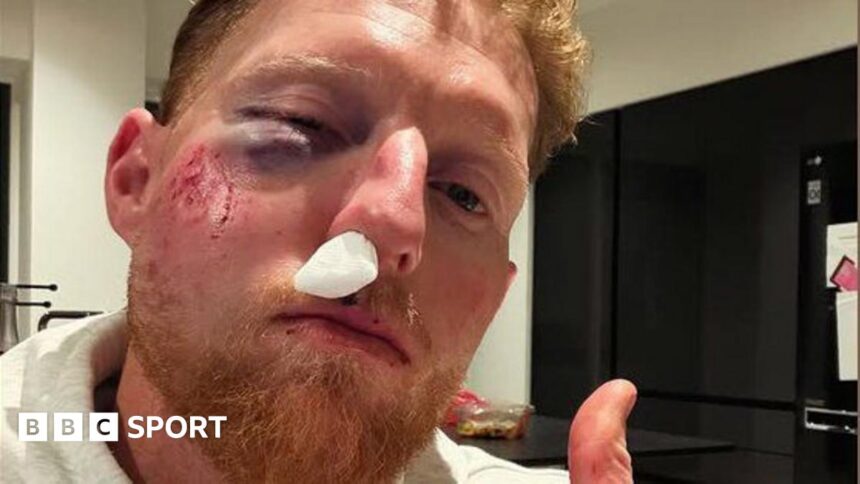 Stokes injured after being hit in face by ball