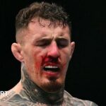 Aspinall must 'ignore' noise after eye surgery - Bisping