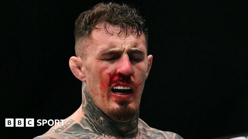 Aspinall must 'ignore' noise after eye surgery - Bisping