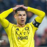 Ronaldo to travel to Spain for hamstring treatment