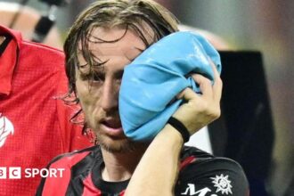 Broken cheekbone but Croatia back Modric recovery for World Cup